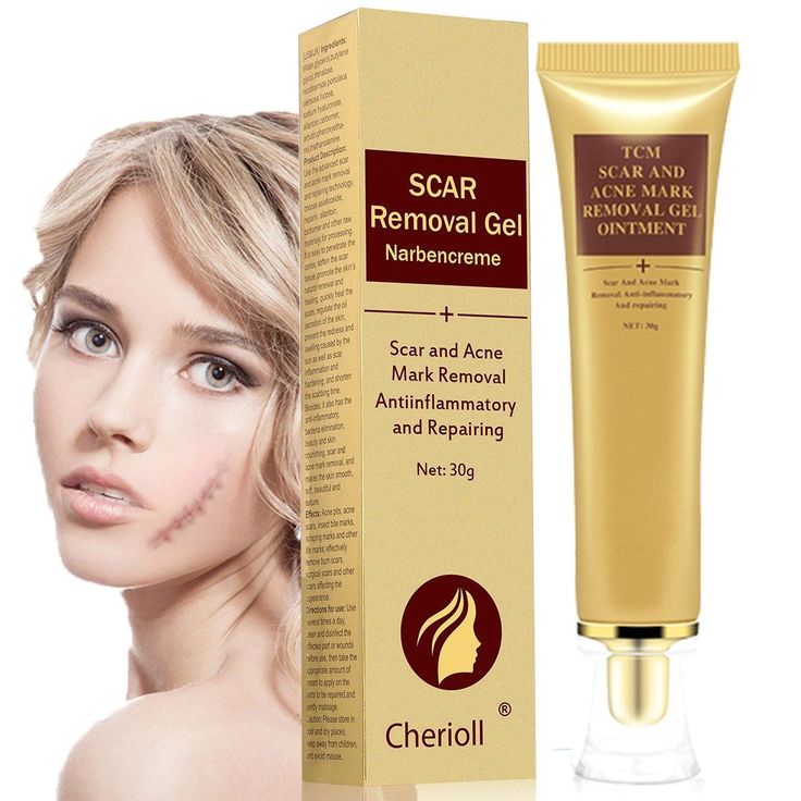 Creme Removedor de Cicatrizes , Acne e Manchas